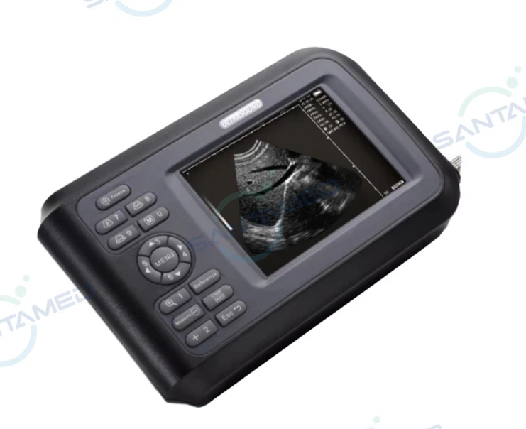 Handheld Ultrasound